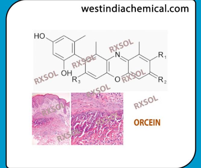 ORCEIN